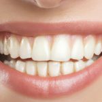 cura-del-sorriso
